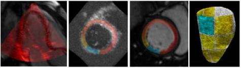 Merging different types of input (e.g. gray level image data, functional and anatomic data) into the same scene