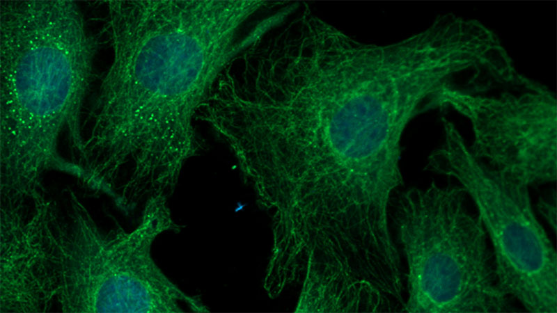 microscope picture of biological cells