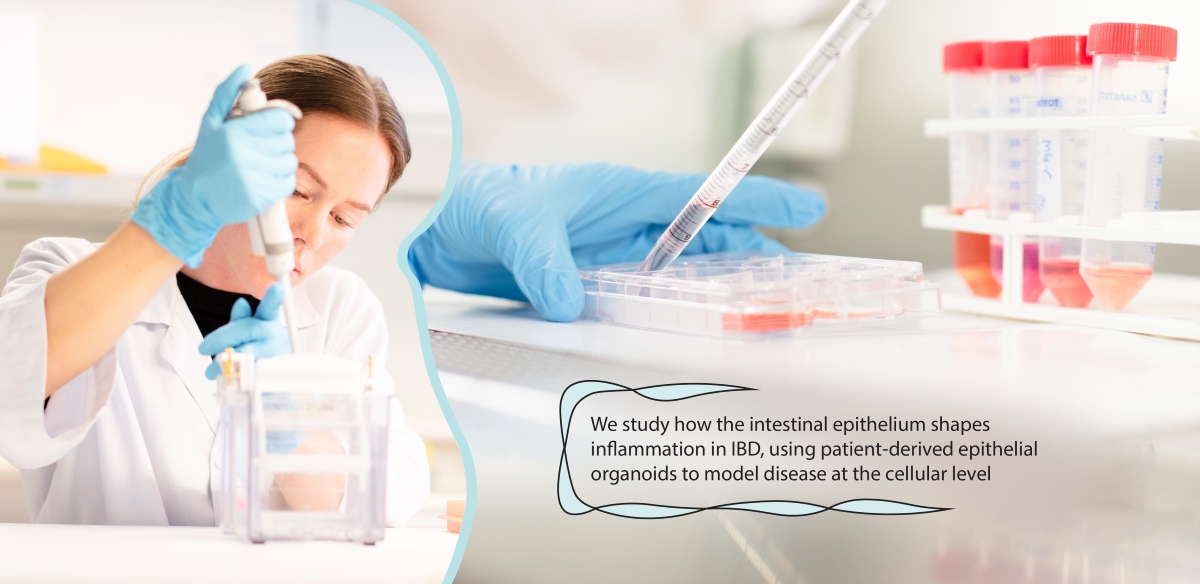 Personnel in lab. Text on photo: We study how the intestinal epithelium shapes inflammation in IBD, using patient-derived epithelial organoids to model disease at the cellular level.