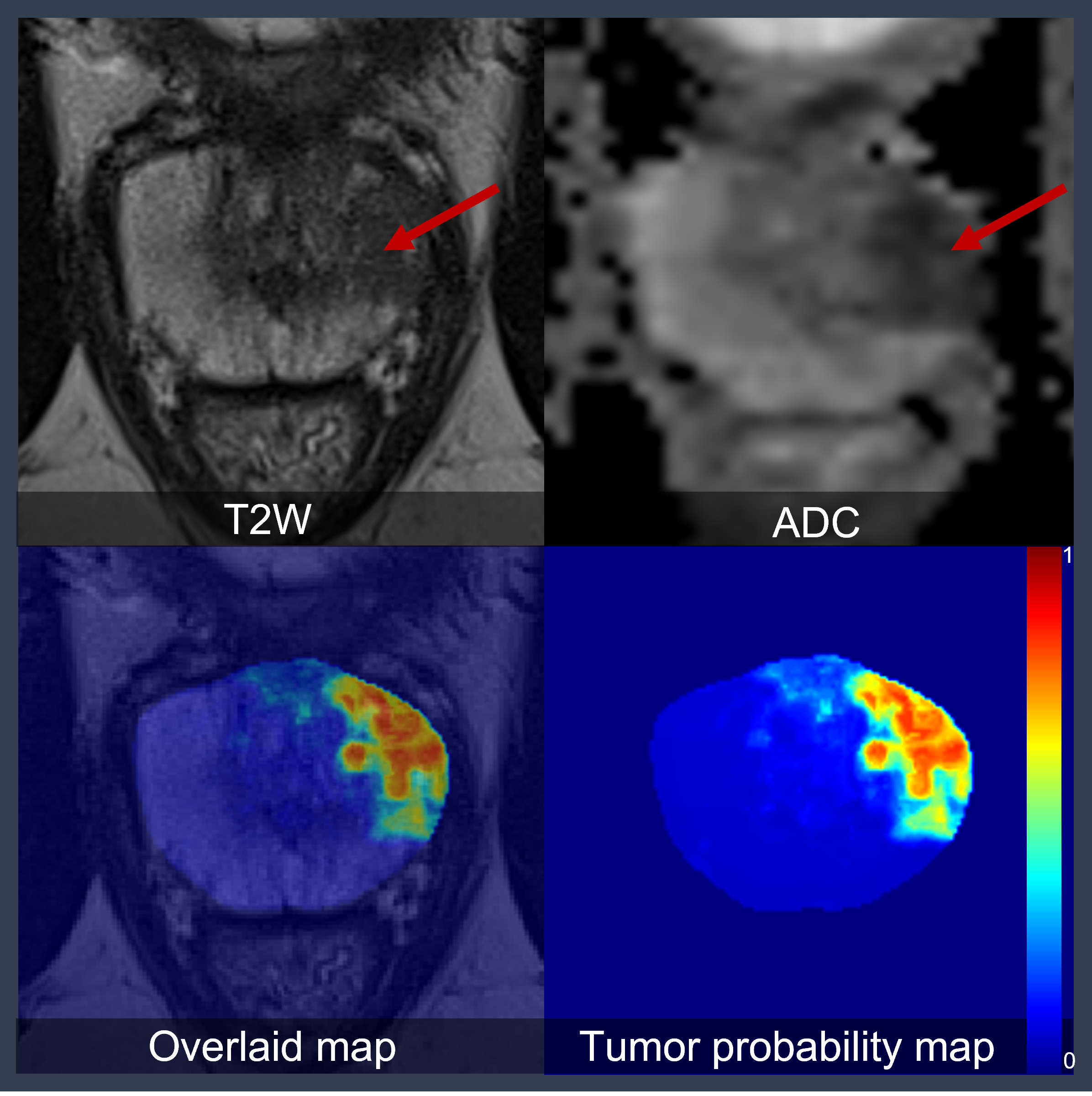 MRI images