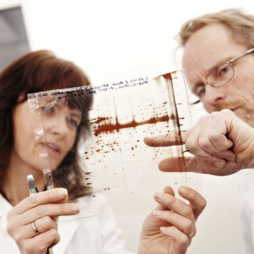 Two researchers study proteins that appear as brown patterns on a glass plate
