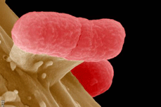 Image of e.coli
