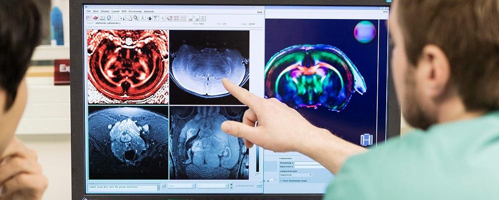 Brain scan on computer screen