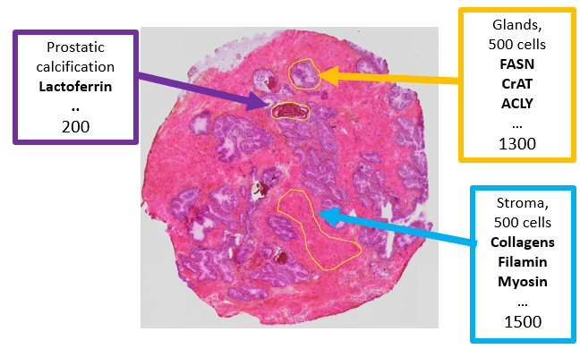 Illustration showing prostate gland sample.