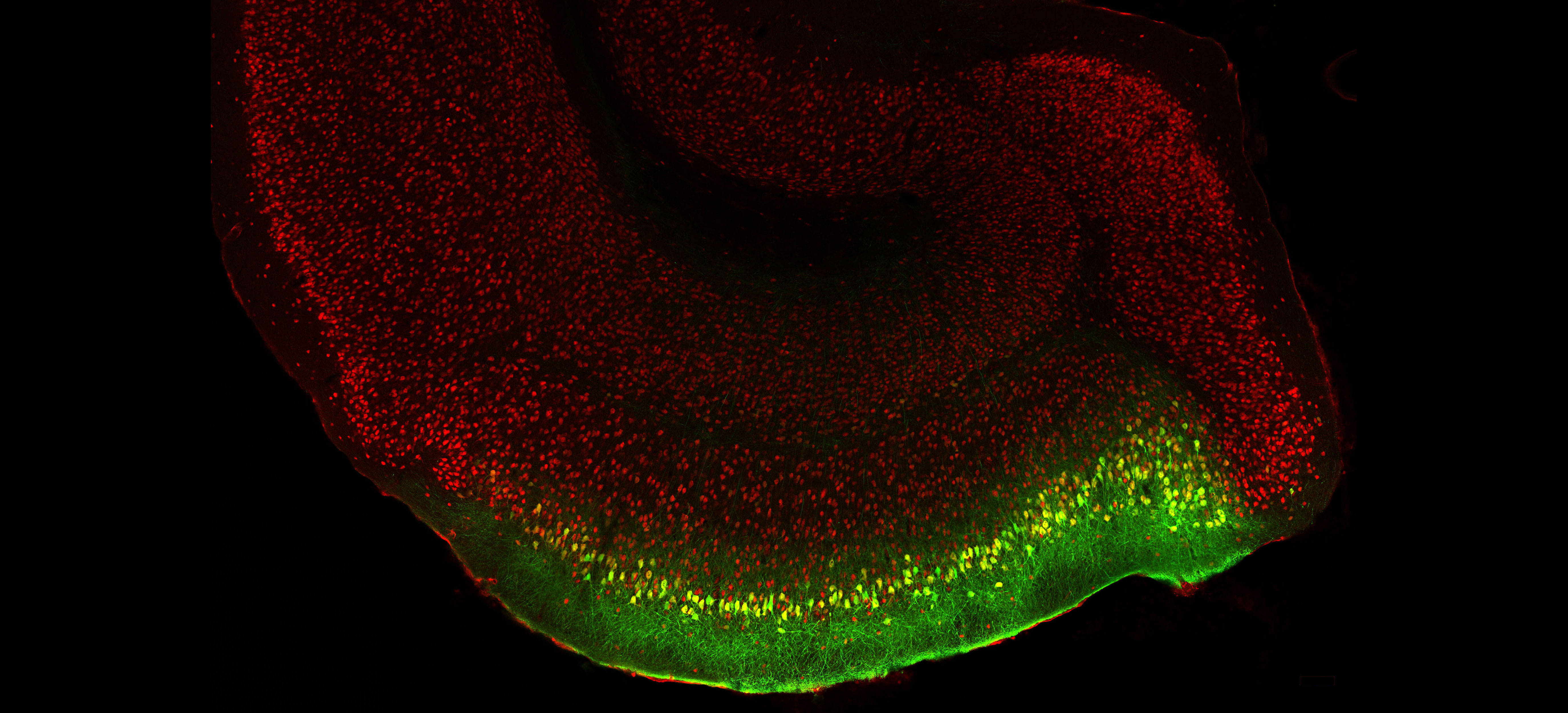 Adeno-associated virus mediated transgene expression (yellow and green color) in medial entorhinal cortex of rat brain. Neurons are shown in red color. This specific gene expression is driven by a medial entorhinal cortex specific enhancer. 