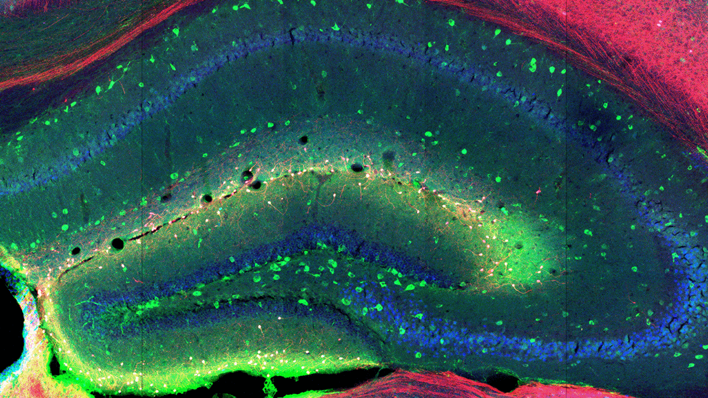 Science image of the hippocampus of a rat brain by Giulia Quattrocolo / Kavli Institute for Systems Neuroscience