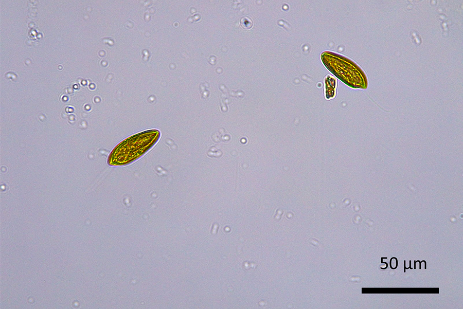 Cryptomonas algae in a microscope