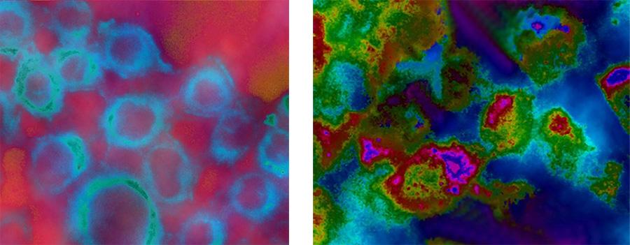 Photodynamic therapy single cells. Two photos from miscroscope