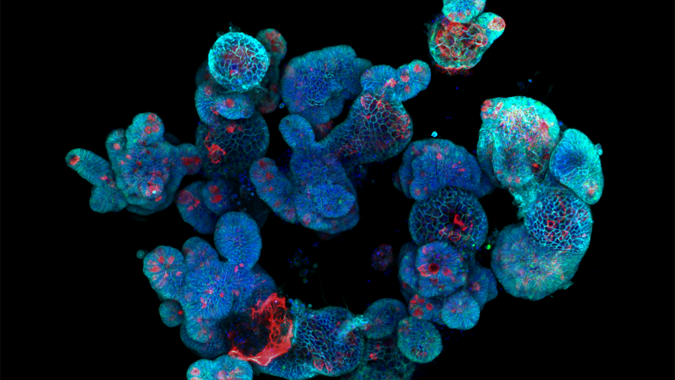 Small intestinal organoids. Tight junctions are highlighted in blue. Goblet cells in red.  Image source: Alberto Diez-Sanchez