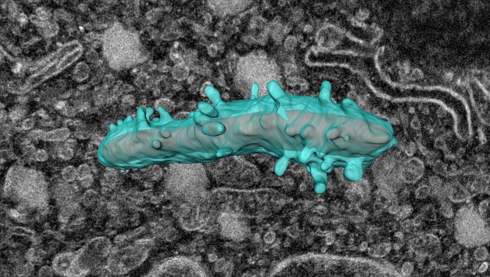 A macrophage infected with Mycobacterium avium was imaged in 3D using a Focused Ion Beam/Scanning Electron Microscope (FIB/SEM) at NTNU Nanolab. Photo