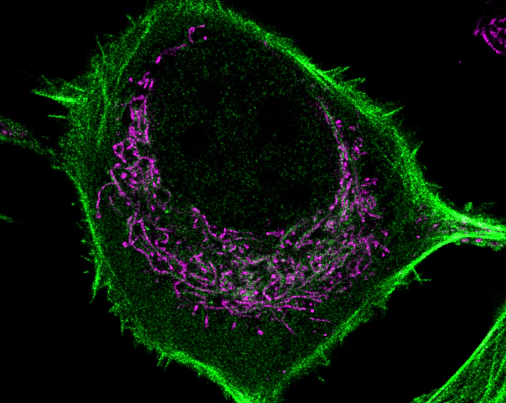 Super-resolution STED microscopy image of NIH-3T3 fibroblast with actin (LifeAct-mNeonGreen) and mitochondria (TMRE, red). Photo