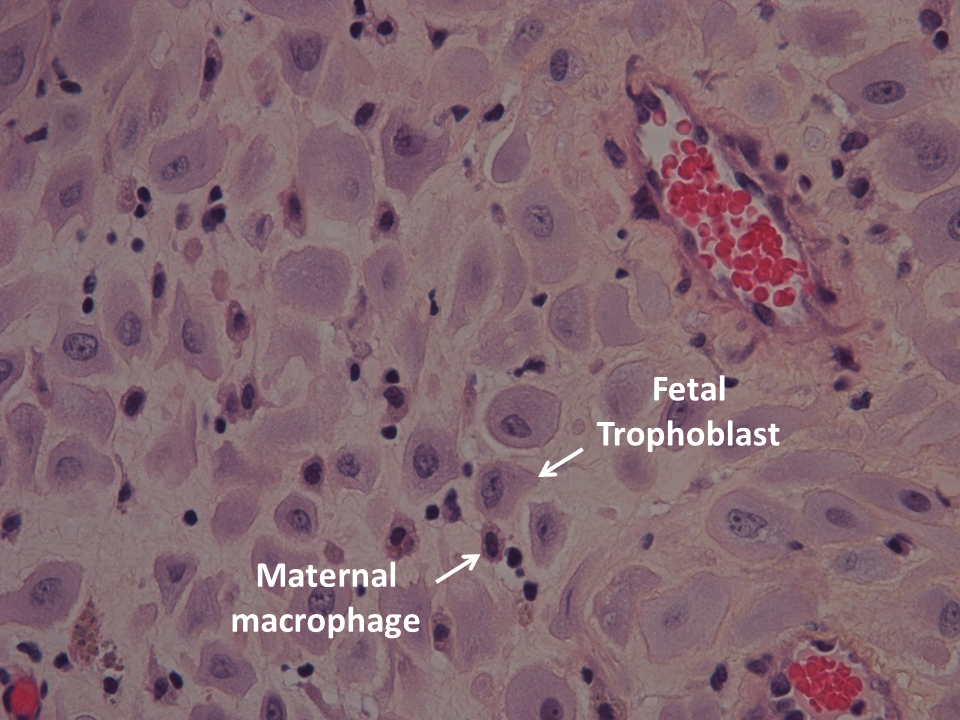 Representative picture of maternal-fetal interaction in third trimester decidua stained with hematoxylin-erythrosine-saffron (HES). Decidual tissue was obtained by vacuum-suction of the uterine  wall, after C-section. Photo