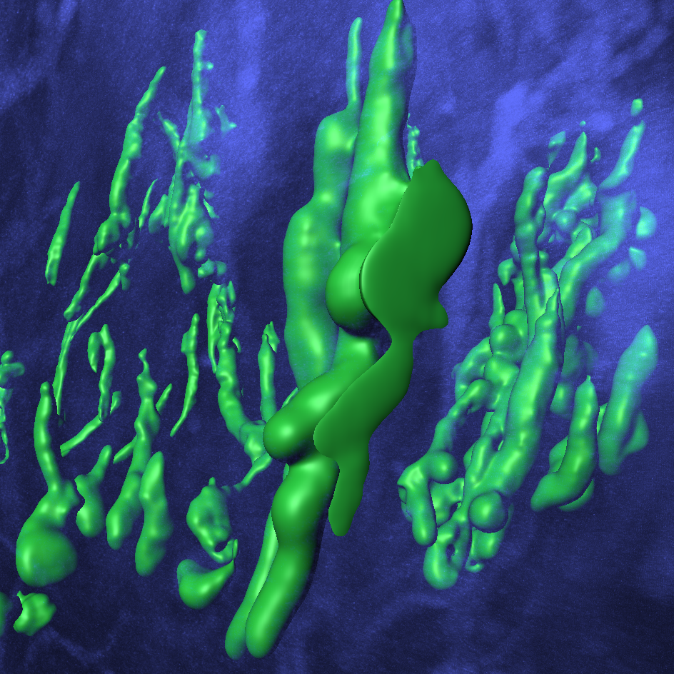 Immunofluorecence staining of NGAL-positive pyloric metaplasia in chronically inflamed human small intestinal tissue. Prior to staining, the tissue was cleared using the iDisco protocol. The image is a 3D visualization of a Z-stack consisting of 452 images, acquired on a Leica SP8 confocal microscope. Photo