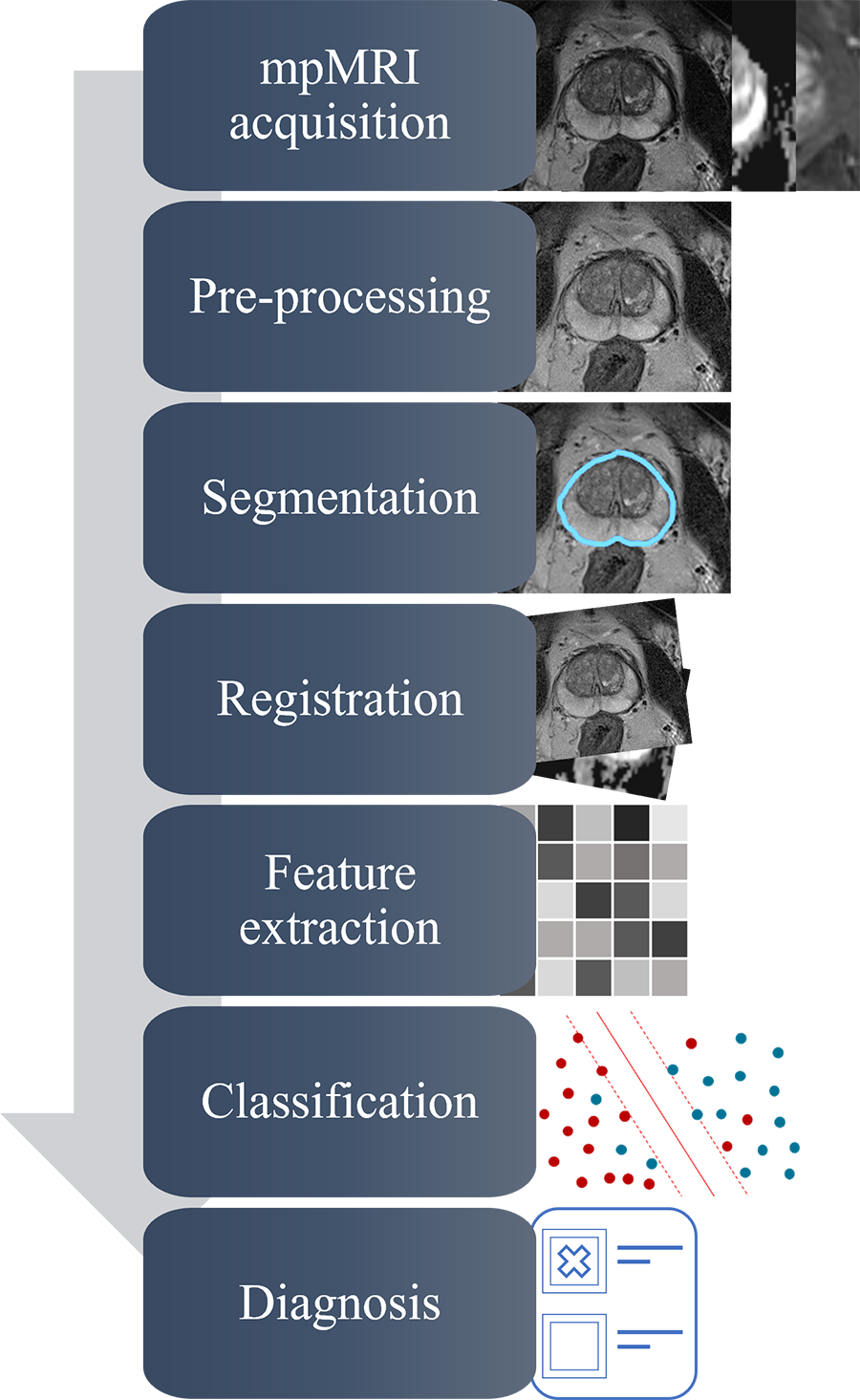 Illustration of MRI photos at different stages of prostate cancer